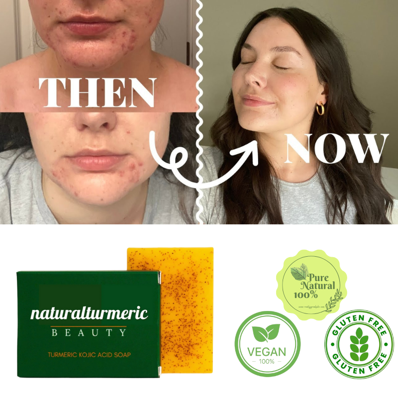 Vegan Natural Turmeric Soap Fix Skin In 5 Days